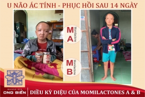 U não ác tính và 14 ngày sử dụng Cám gạo Ong Bển (BN106 -Tiêu Hoàng Âu)